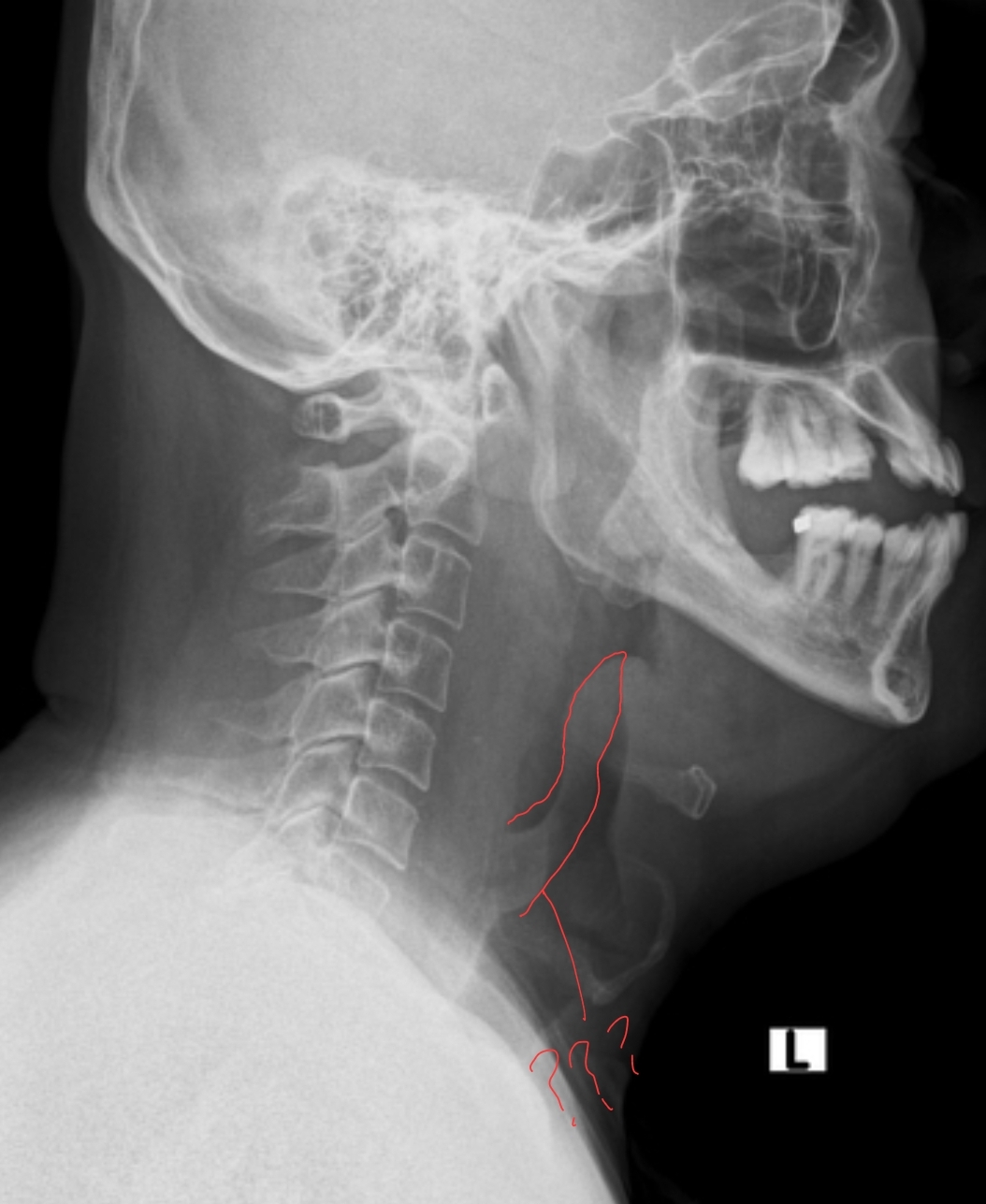 이 튀어나온 구조물은 무엇인가요 - 2025년 전공의시험 1회 91번 | 메디톡, image size:1054x1287