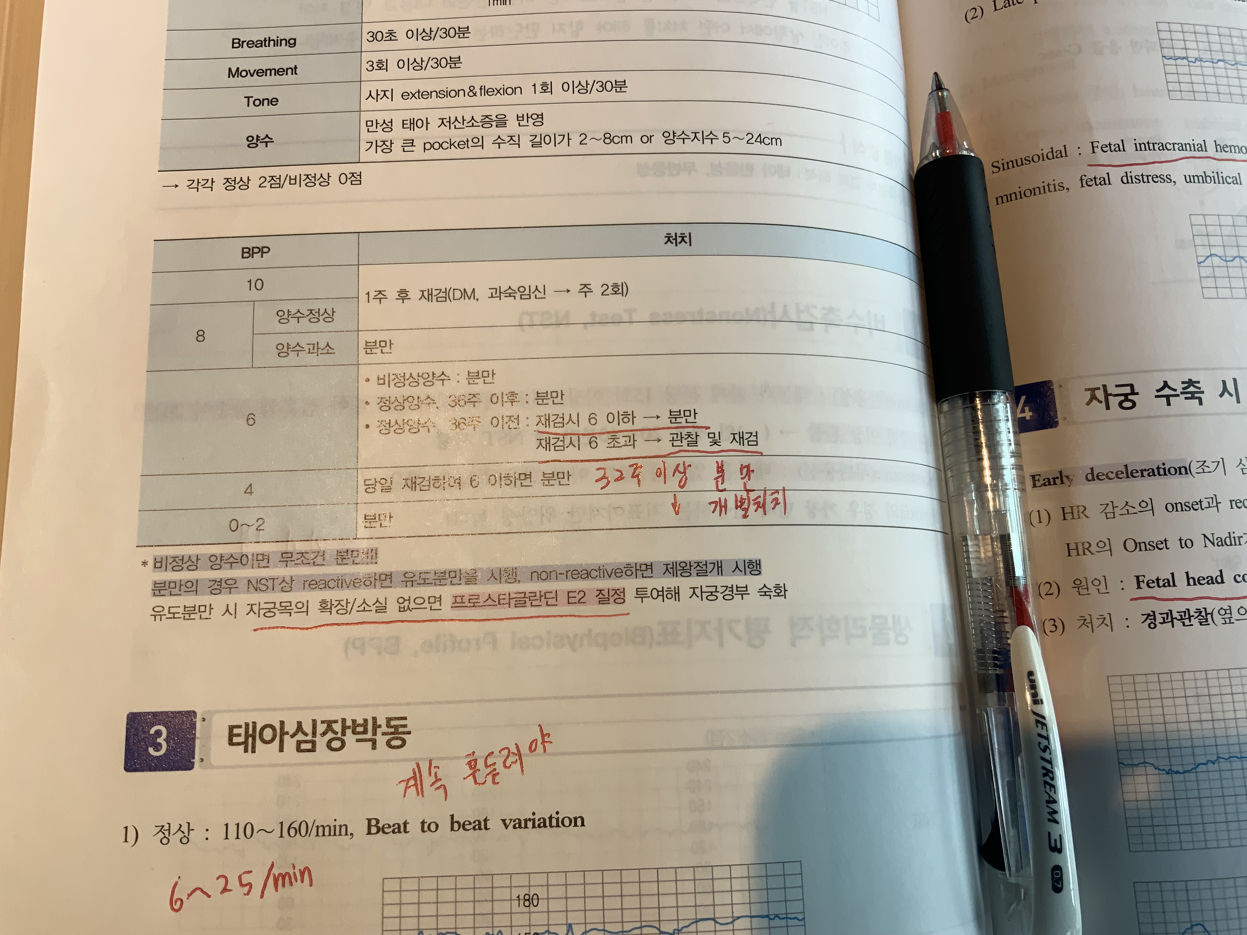 개념서에는 이렇게 써있는데 구식인가요?