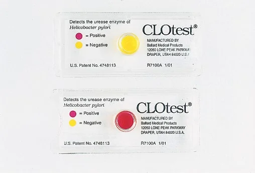 Urease test | Principle | Protocol | Results