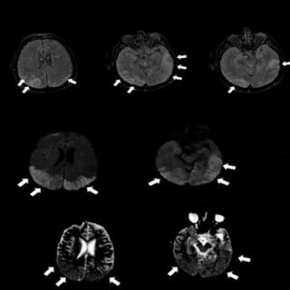 Radiological findings of the patients | Download Scientific Diagram