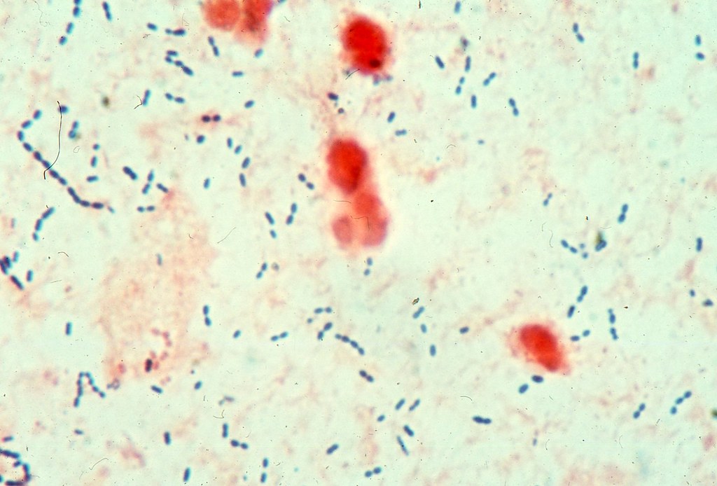 Streptococcus pneumoniae | Streptococcus pneumoniae in sputu… | Flickr