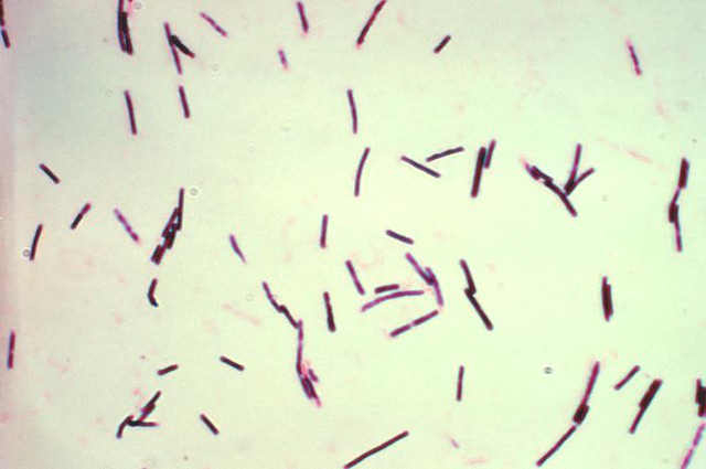 Clostridum perfringens | Gram Stain result for Clostridium p… | Flickr