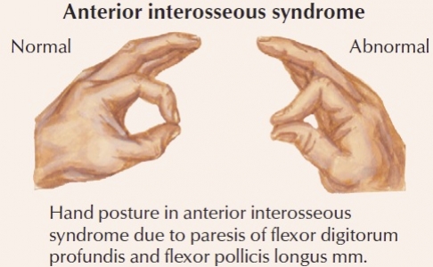 Median Nerve | JC Physiotherapy